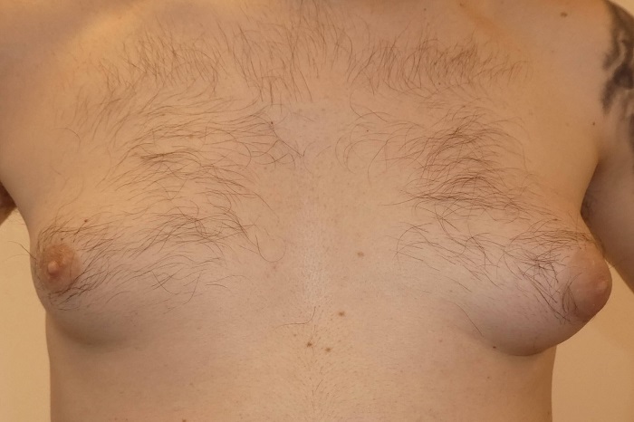 AVS PLASTIC SURGERY AND SKIN CLINIC Pudukkottai