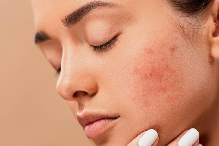 AVS PLASTIC SURGERY AND SKIN CLINIC Pudukkottai