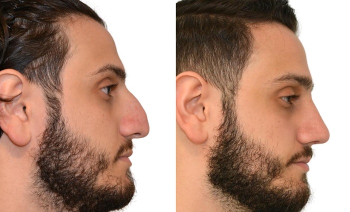 AVS PLASTIC SURGERY AND SKIN CLINIC Pudukkottai